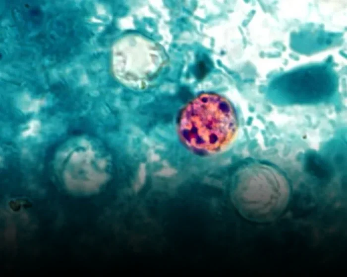  The Invisible Cost of Disbanding Federal Cyclospora Research